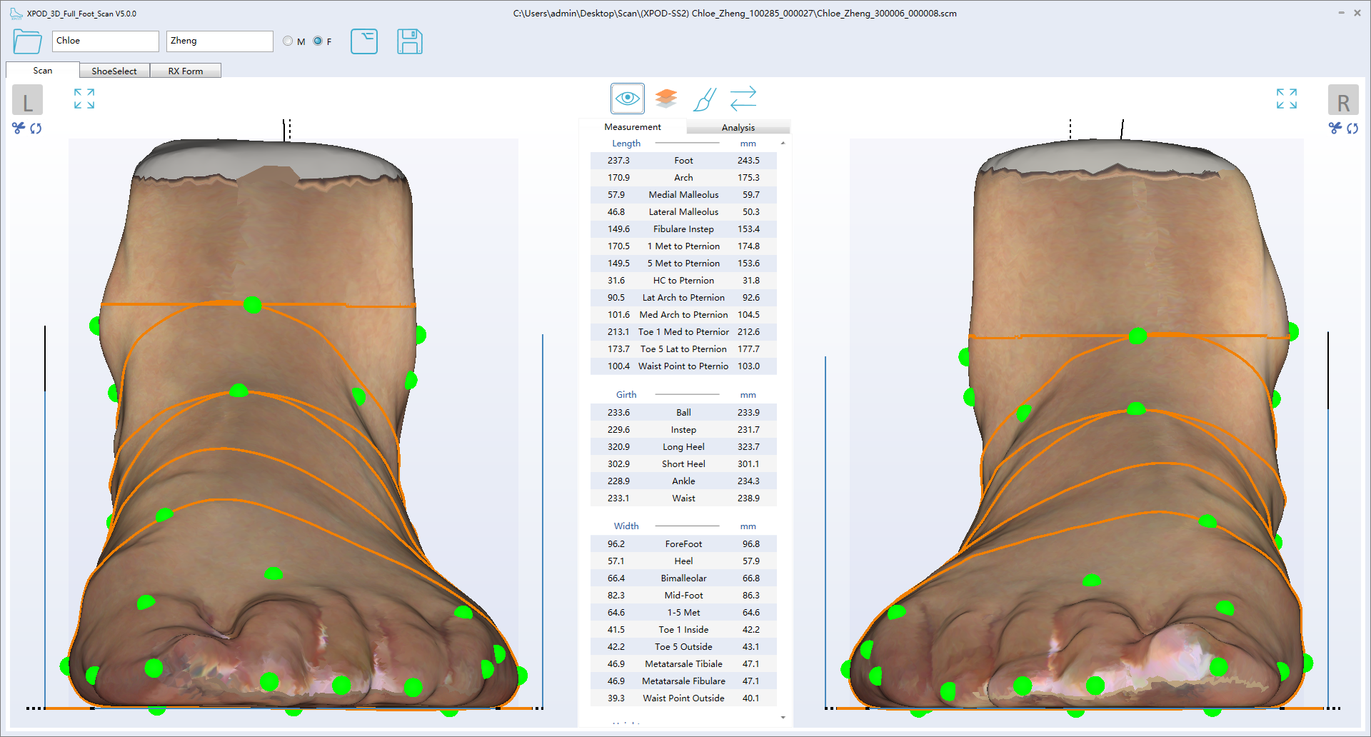 ScanPod3D 3D Laser Foot Scanner | Orthotic Insole CAD & CAM ...