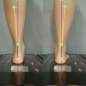 3D foot scanner 三维足部扫描仪