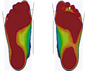 3D foot scanner 三维足部扫描仪