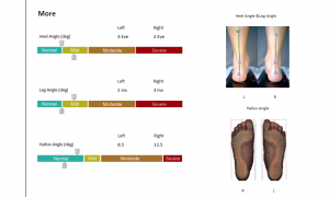 3D foot scanner 三维足部扫描仪