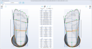 3D foot scanner 三维足部扫描仪