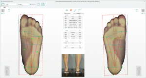3D foot scanner 三维足部扫描仪