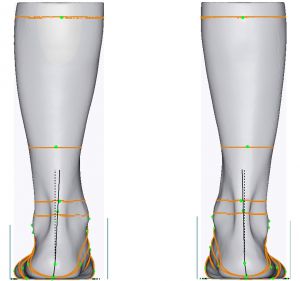 3D foot scanner 三维足部扫描仪
