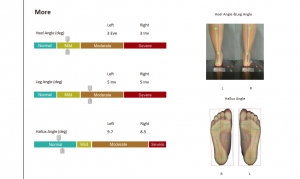 3D foot scanner 三维足部扫描仪
