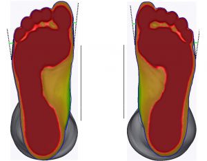 3D foot scanner 三维足部扫描仪