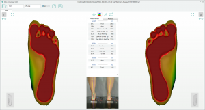 3D foot scanner 三维足部扫描仪