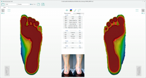 3D foot scanner 三维足部扫描仪