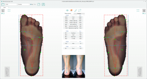 3D foot scanner 三维足部扫描仪