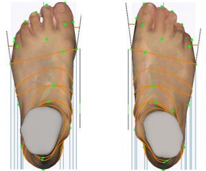 3D foot scanner 三维足部扫描仪
