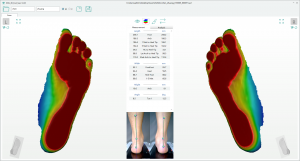 3D foot scanner 三维足部扫描仪