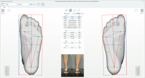 3D foot scanner 三维足部扫描仪
