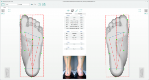 3D foot scanner 三维足部扫描仪