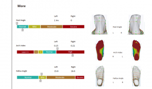 3D foot scanner 三维足部扫描仪