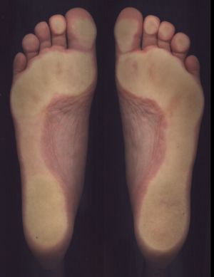 3D foot scanner 三维足部扫描仪