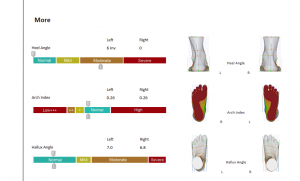 3D foot scanner 三维足部扫描仪